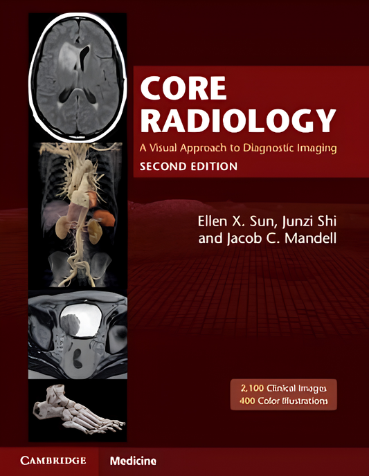 Core Radiology: A Visual Approach to Diagnostic Imaging 2nd Edition ISBN - 9781108965910